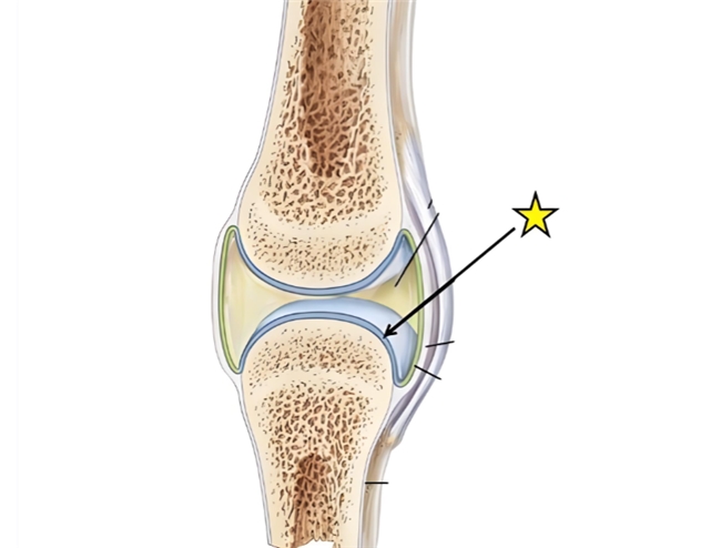 寒假将至，养护关节刻不容缓！盐酸和硫酸氨基葡萄糖胶囊如何选？