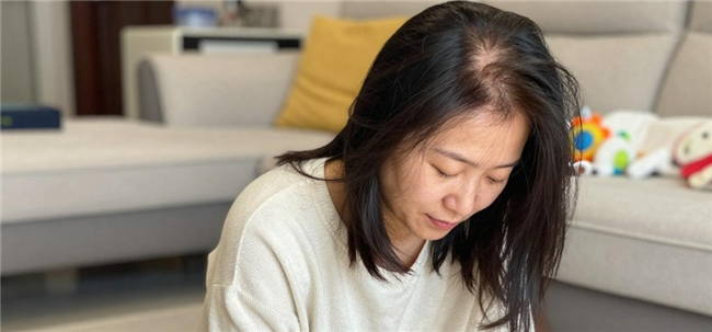 产后妈妈的脱发焦虑,别让气血大亏拖垮你的头发
